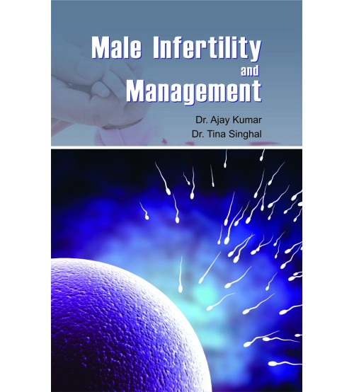 Male Infertility & Management