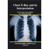 Chest X-Ray and Its Interpretation