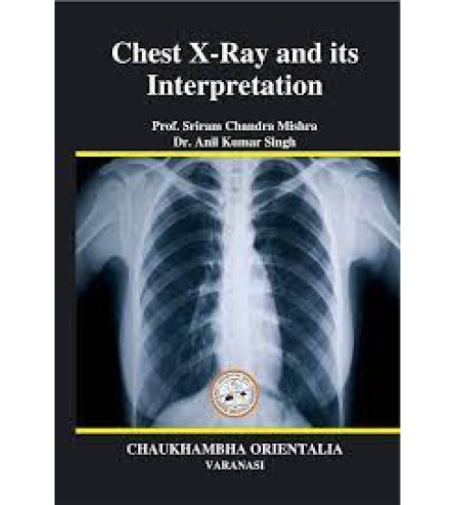 Chest X-Ray and Its Interpretation